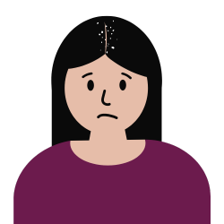 Dry Scalp