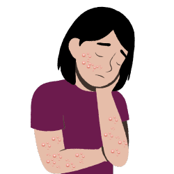 New Moles or Lesions