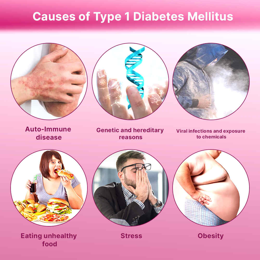 causes of diabetes mellitus type 1