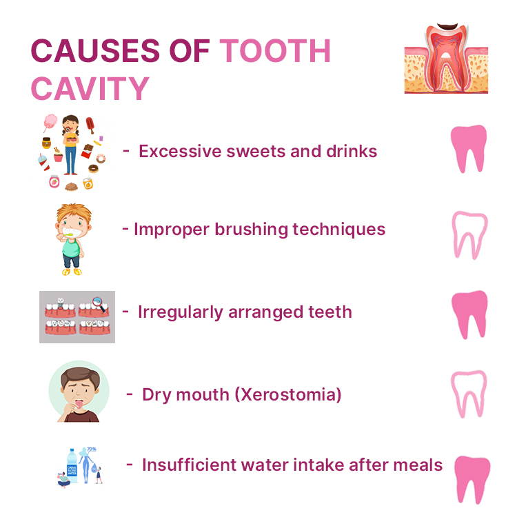 Causes of Tooth Cavity
